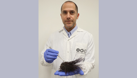 פרופ' עמרי ברונשטיין וקיפוד ים גוסס